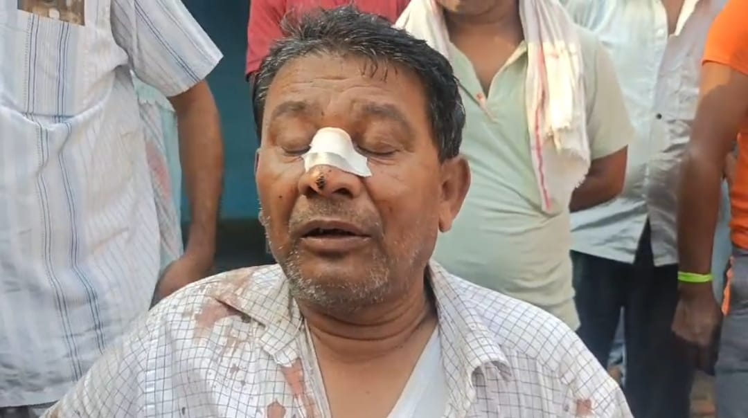বাস চালককে মারধরের অভিযোগে উত্তেজনা বরাকরে বাস চালককে মারধরের অভিযোগে উত্তেজনা বরাকরে
