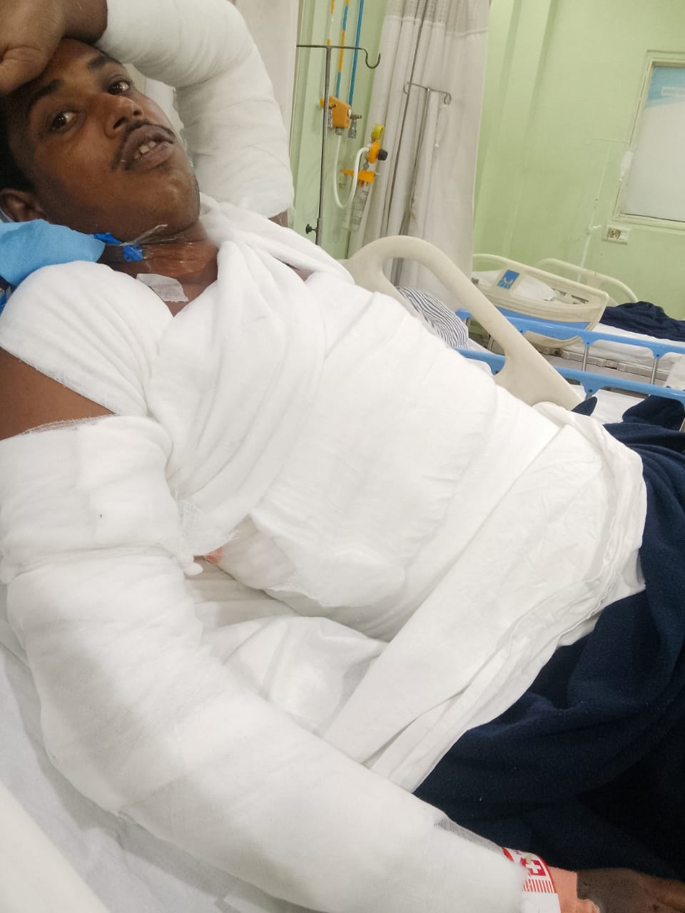 এলোকুইন্ট কারখানার গলিত লোহা ছিটকে গুরুতর জখম পাঁচ শ্রমিক এলোকুইন্ট কারখানার গলিত লোহা ছিটকে গুরুতর জখম পাঁচ শ্রমিক