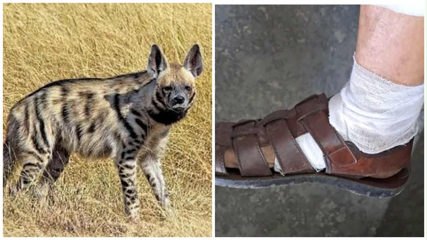 চিত্তরঞ্জনে রেল শহরের হায়নার আক্রমনে আহত এক ব্যক্তি প্রশ্নের মুখে চিত্তরঞ্জন এর নিরাপত্তা ব্যাবস্থা